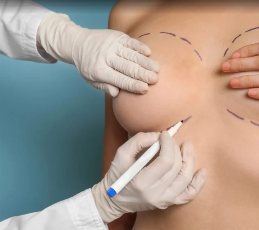 Why Choose Dubai for MIA Breast Implant
