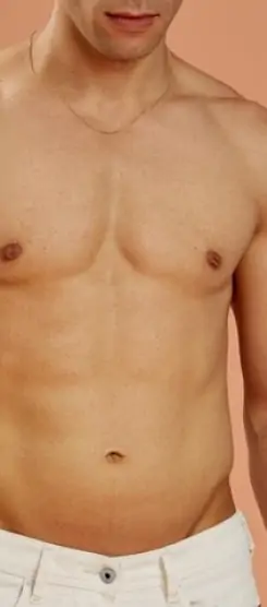 كل ما تحتاج معرفته عن شفط الدهون في جدة بنتائج متوازنة